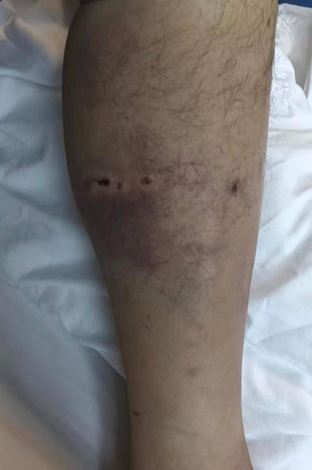 皇冠信用平台出租_重庆一男子上山采菌后遇熊袭击皇冠信用平台出租,幸亏穿了雨靴!20余名村民连夜救援